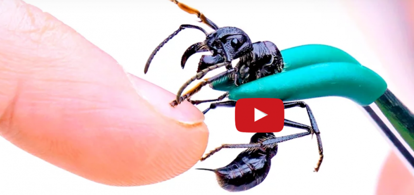 Stung By A Bullet Ant